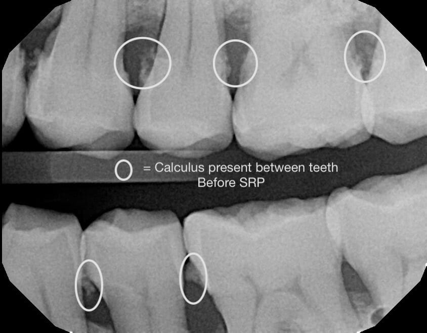 https://www.monfredifamilydental.com/i-need-a-deep-cleaning-what-is-that/x660635535_2/